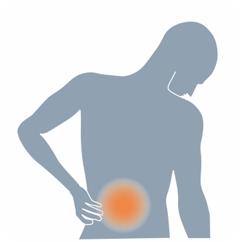腰コリによる腰痛悪化